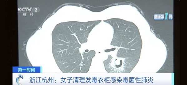 墻面發(fā)霉致癌？電滲脈沖技術(shù)‘抽干’墻體水分，30年不發(fā)霉
